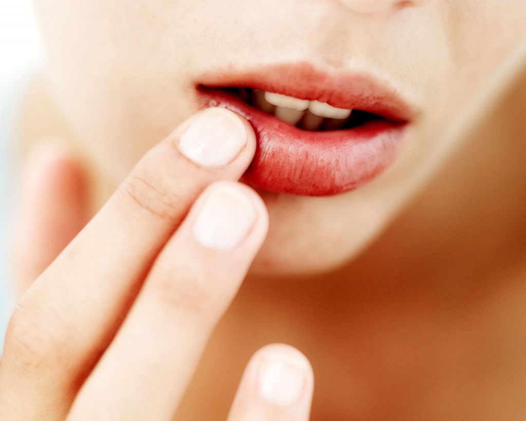 chapped-lips-this-winter-tips